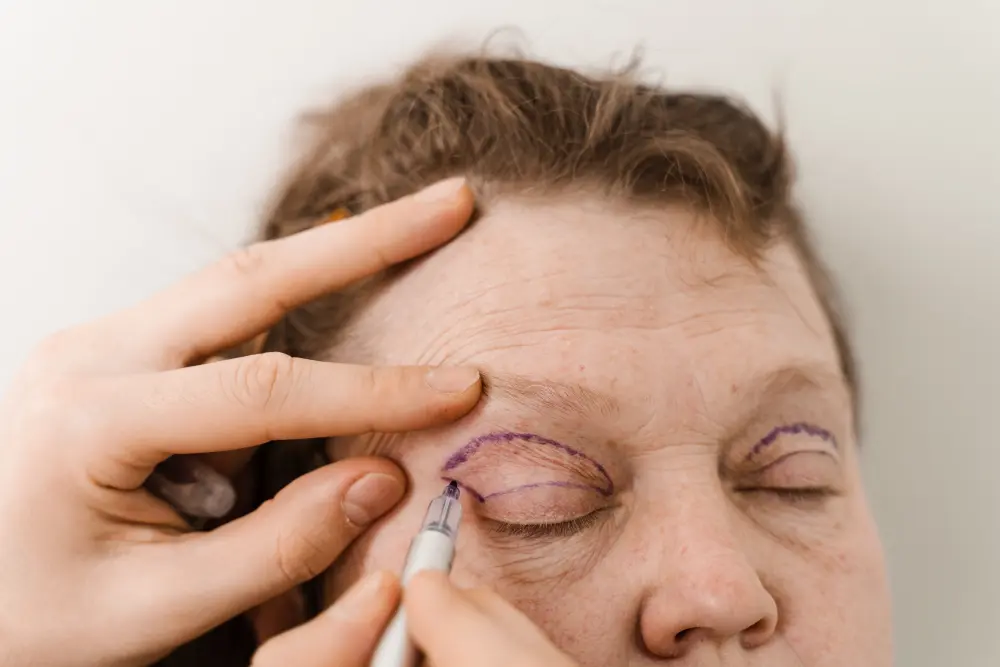 La cirugía plástica ocular prioriza la anatomía palpebral, la función ocular y la seguridad del paciente.