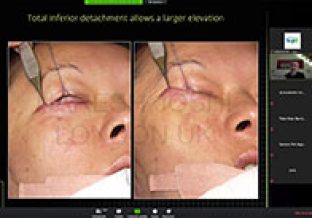 webinar-01-gallery02