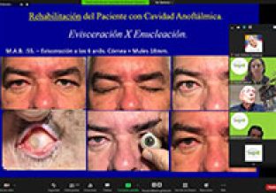 webinar-02-gallery03