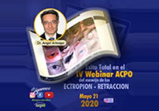 webinar-04-gallery01