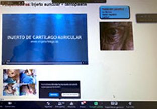 webinar-04-gallery03